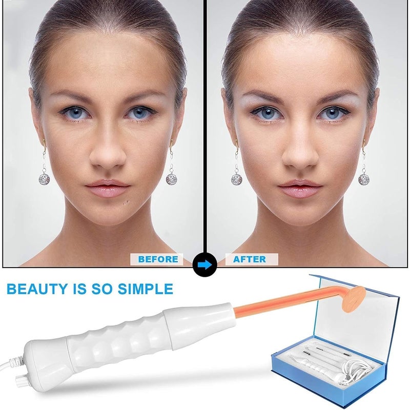 deziine SWEETPEAFx Portable High Frequency Machine Facial Wand Acne for Skin Tightening Acne Spot Wrinkles Reducing Puffy Eyes Dark Circles Dispel Freckle 4 in 1 Handheld High Frequency Machine for Face Hair - Image 3