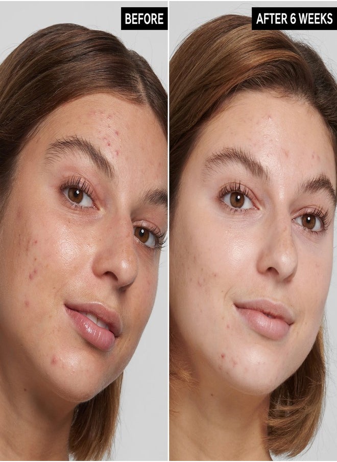 The Inkey List - The Inkey List Vitamin B C And E Moisturizer 50ml - Image 1