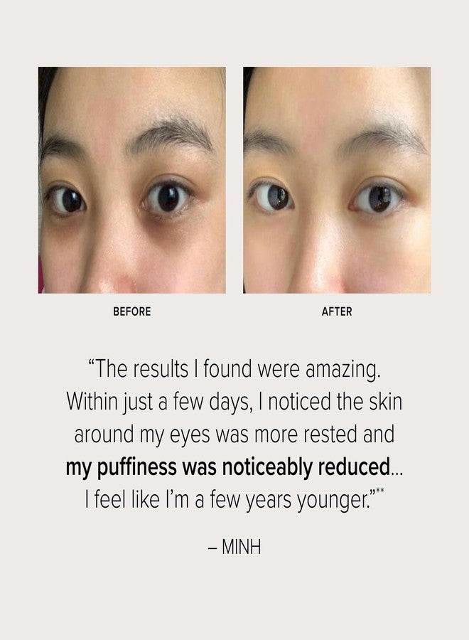 Serovital Beauty Dark Circle Eraser Eye Cream - Brightening & Anti‑Puffiness Under-Eye Treatment with Peptides, Ginseng & Lupin - Hormone-Aware, Clinically Tested - 0.5 oz - Image 5