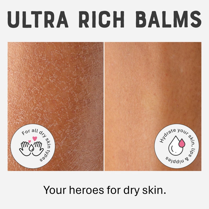 DR. LIPP Dry Skin Heroes [BFF ultra rich Balm 30ml & Original Nipple Balm 8ml] – 14-in-TWO Multi-Use Balms for Lips, Nipples & More – 100% Natural Coconut Oil & Lanolin – Fragrance & Cruelty Free - Image 4