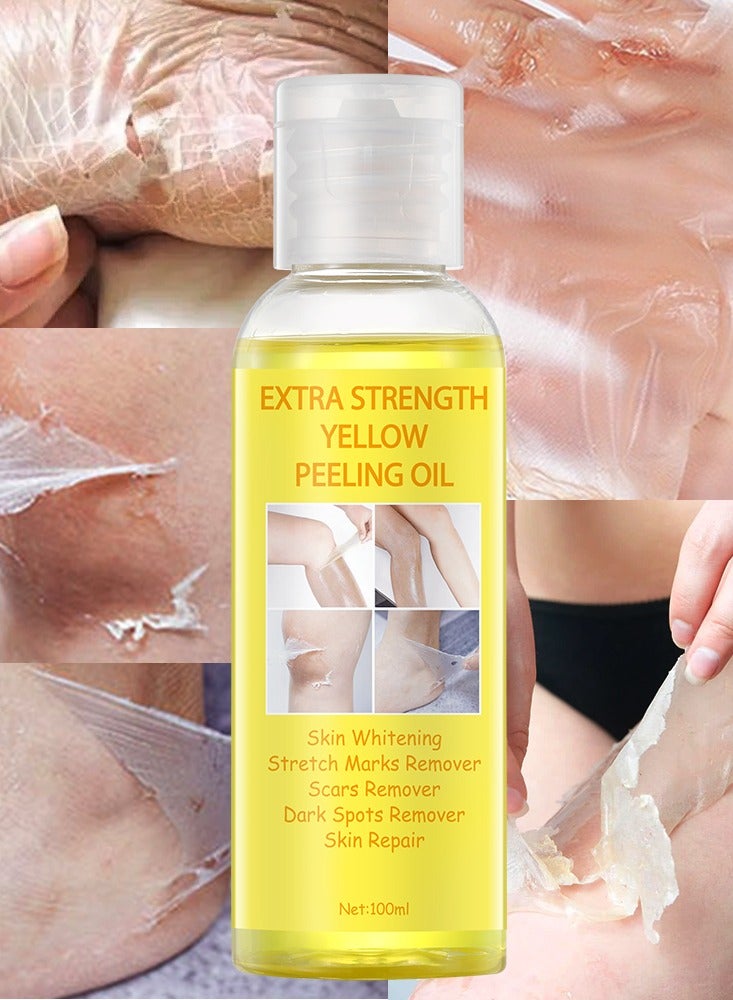 MOOYAM Yellow Peeling Oil Super Strength Dead Skin Remover Skin for Dark Skin, Face, Body, Dark Spots and Skin Lightening (100 ml) for Unisex, for All Skin Types - Image 1