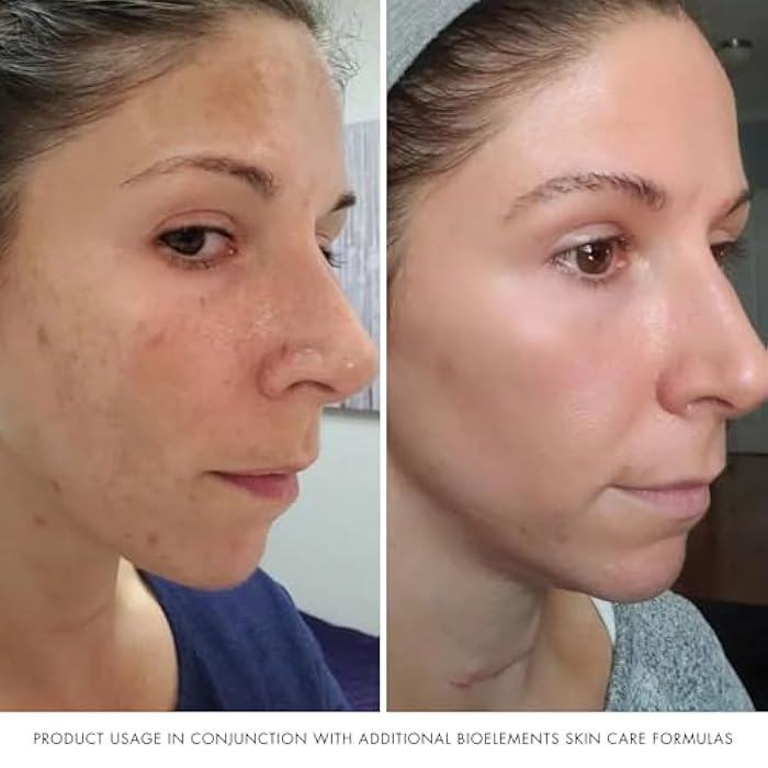 Bioelements Absolute Moisture - 2.5 oz - Lightweight Facial Moisturizer for Combination Skin - Smooth, Soft & Shine Free - Vegan, Gluten Free - Never Tested on Animals - Image 5