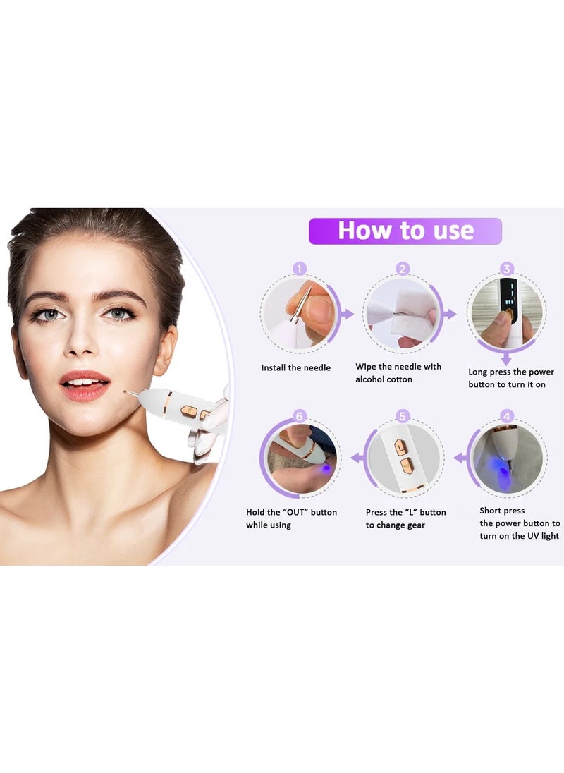 General - Laser plasma pen skin tag remover mole wart remover mole blackhead removal face body mole removal pen - Image 1