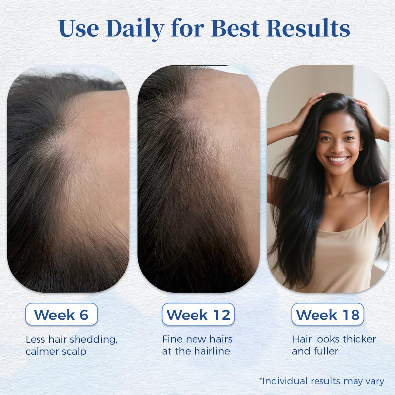 Gluvelessia Hair Growth Serum Roll On with Rosemaryï¼ŒHelps Support Thicker, Fuller Hair Appearanceï¼ŒClean, Non-Greasy Hair Loss Support for Men & Womenï¼ŒSaw Palmettoï¼Œ0.84 Fl Oz (Pack of 1) - Image 3