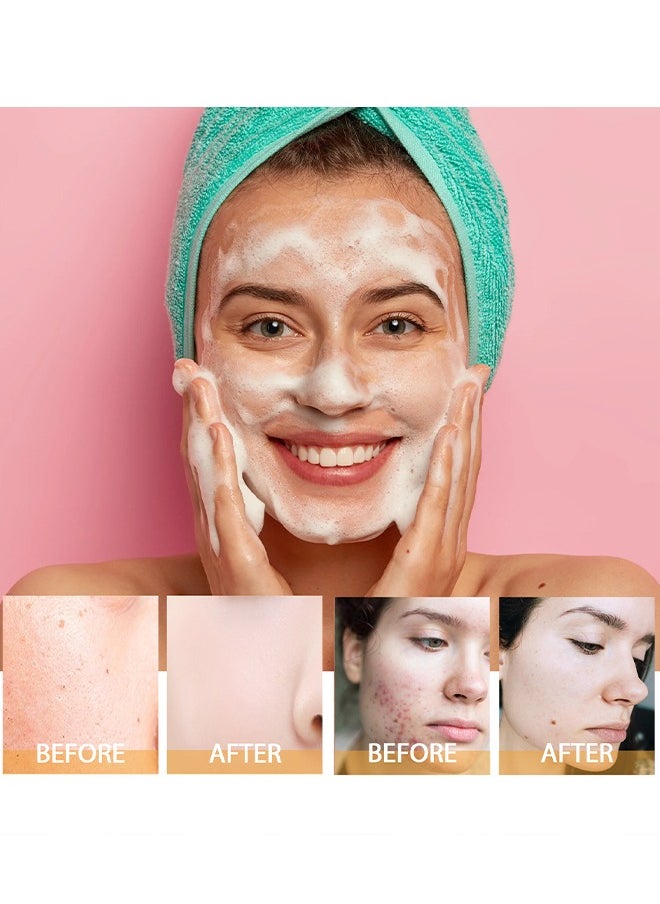 Hoygi - Brightening Facial Cleanser - Turmeric Cleanser Deep cleans facial skin, fades acne marks, moisturizes, whitens and beautifies skin 100ML - Image 1