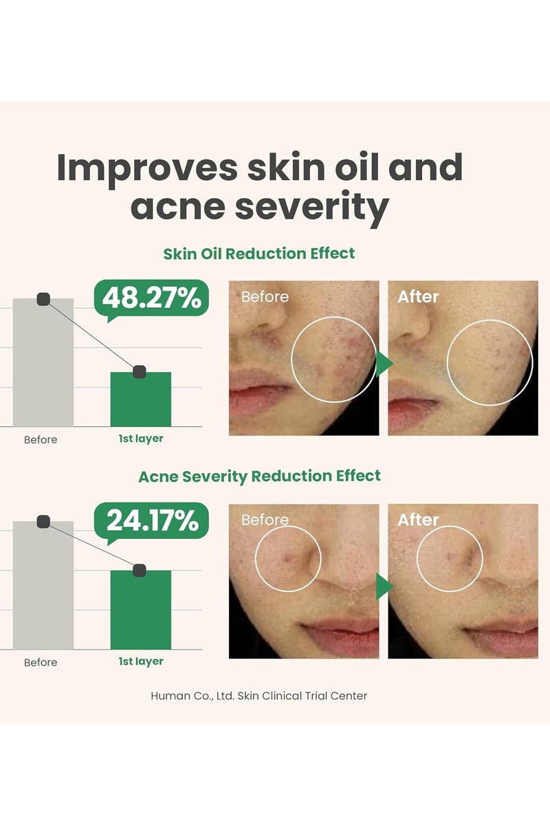 AXIS-Y Spot the Difference Blemish Treatment 15ml - Image 3