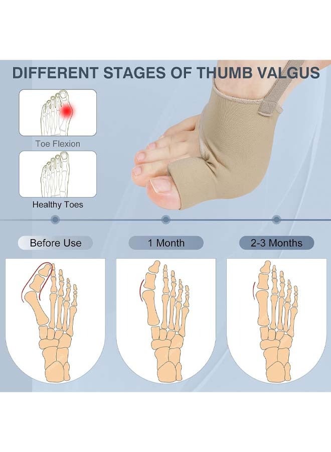 Generic Bunion Corrector Orthopedic Splint Big Toe Separator Pain Relief Non-Surgical Hallux Valgus Correction Straightener for Women Men Day Night Support 1Pair  - Image 3