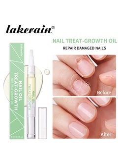 Nail Oil Treat Growth-Cuticle Oil Strengthens Nail Cuticles Removes Moisturizes and Nourishes - pzsku/ZAB1B2741C0D4B2F9C538Z/45/_/1718197877/77fbe68f-e5c2-49bb-a4ba-c3dc7ec71fd1