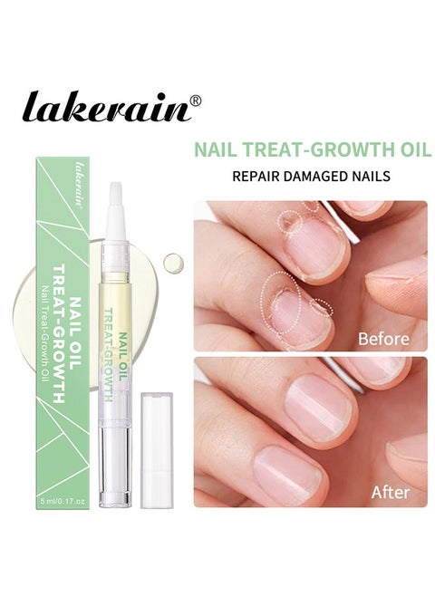 Nail Oil Treat Growth-Cuticle Oil Strengthens Nail Cuticles Removes Moisturizes and Nourishes