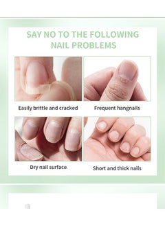 Nail Oil Treat Growth-Cuticle Oil Strengthens Nail Cuticles Removes Moisturizes and Nourishes - pzsku/ZAB1B2741C0D4B2F9C538Z/45/_/1718197878/115cf88d-1cba-4902-a5f5-03e9b934f94c