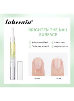 Nail Oil Treat Growth-Cuticle Oil Strengthens Nail Cuticles Removes Moisturizes and Nourishes - pzsku/ZAB1B2741C0D4B2F9C538Z/45/_/1718197881/4d7d0d5b-df1e-4c1b-91d7-5c7a495de92d