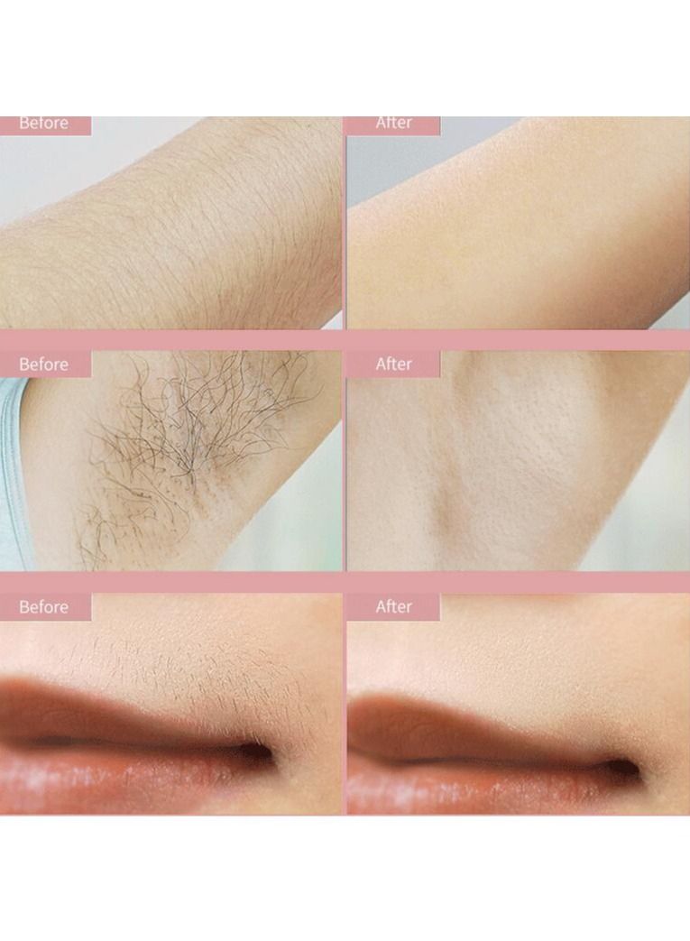 NIBEMINENT IPL Intelligent Laser Hair Removal System - Image 3