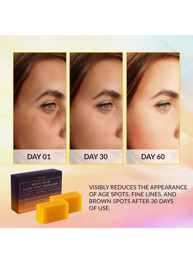 VALITIC 4 Pack Kojic Acid Dark Spot Remover Soap Bars With Vitamin C Retinol Collagen Turmeric Original Japanese Complex With Hyaluronic Acid & A Pair Of Black Exfoliating Gloves For Body Scrub  - Image 3