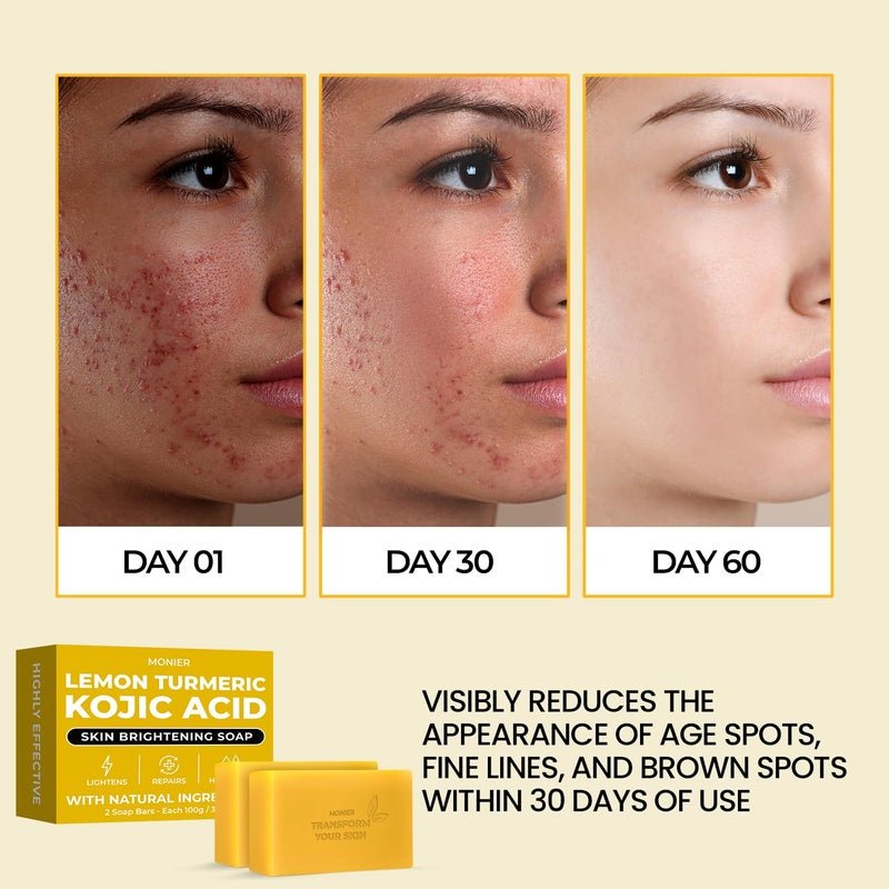 MONIER Brightening Lemon Turmeric Kojic Acid Soap Bars with Collagen Turmeric Coconut Oil Vitamin C Vitamin E Moisturizing Nourishing Original Japanese Complex 2 Soap Bars Storage Net - Image 2