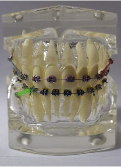 OrthoUnion Orthodontic Dental Demonstration Teeth Model Study Teaching Dental Model 
