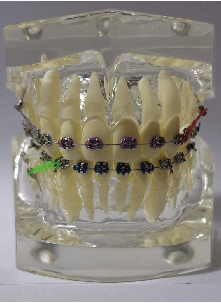 OrthoUnion Orthodontic Dental Demonstration Teeth Model Study Teaching Dental Model 