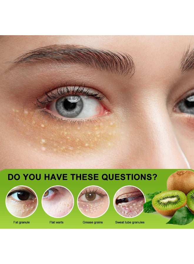 Sumifun 2-Pcs Vitamin E Fat Granule Cream Firms and Repairs Skin Around Eyes Eye Health Support Effective Removal of Fat Particles Granules Specific Eye Care Under Eye Care Cream 20g - Image 3