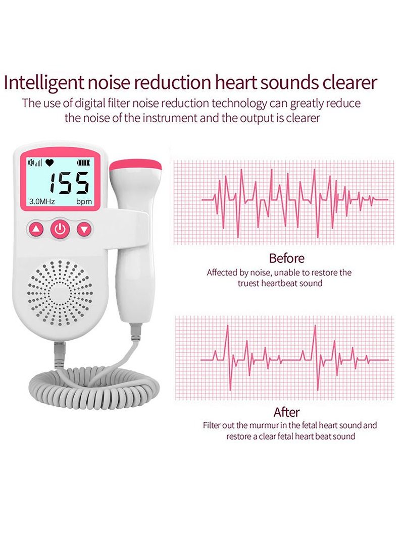 general Portable Ultrasound Doppler Fetal Heart Rate Monitor with LCD Screen - Image 5