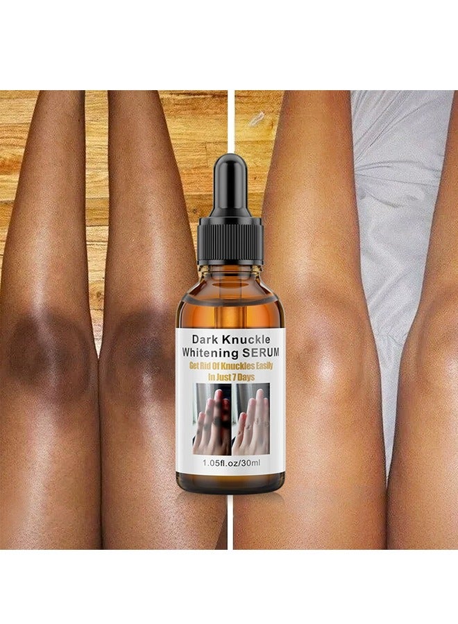 MOIKA Joint Whitening Essence Liquid for Removing Dark Spots on Elbows Knees and Ankles - Image 2