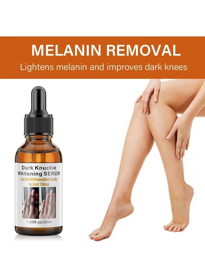 MOIKA Joint Whitening Essence Liquid for Removing Dark Spots on Elbows Knees and Ankles - Image 3