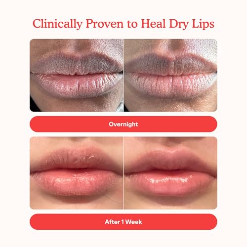 Tower 28 LipSoftie Hydrating Tinted Lip Treatment Balm, Moisturizing Lip Mask for Chapped Lips - Watermelon Kiwi Flavor, Sheer Baby Pink Gloss - Image 3
