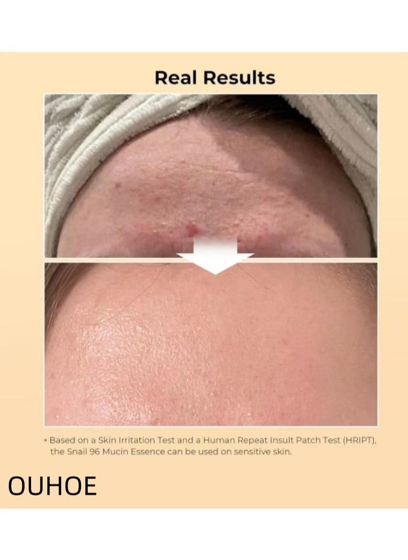 OUHOE - Glow Revival Essence - Brightens, Hydrates & Reduces Dark Spots | Anti-Aging Treatment - Image 1
