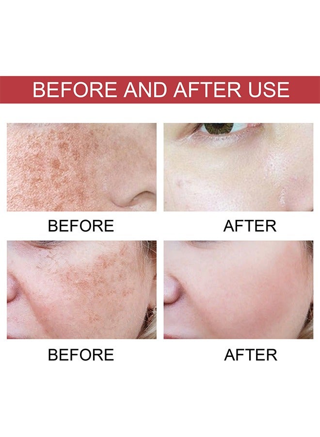 Hoygi Dark Spot Correcting Serum，Dark Spot Repair Essence | Fades Dark Spots, Pigmentation, and Age Spots, Moisturizes and Brightens Skin 30ml  - Image 4