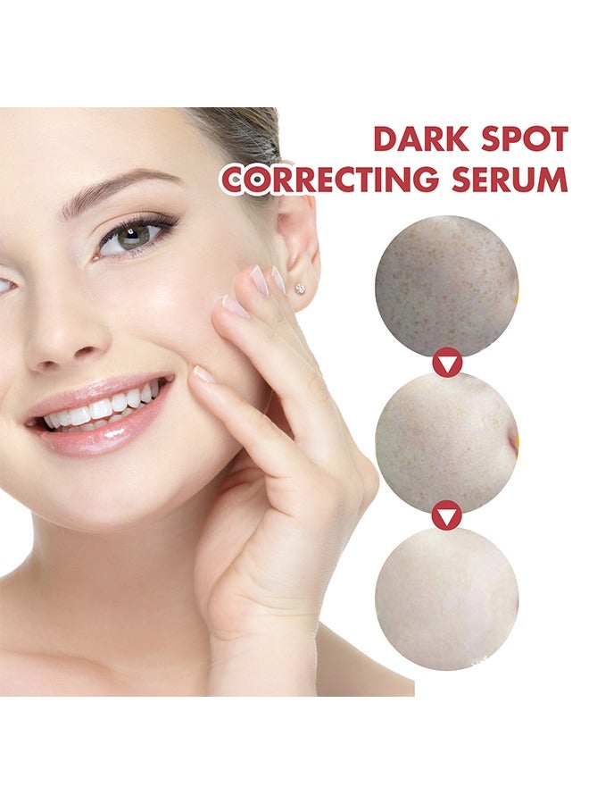 Hoygi Dark Spot Correcting Serum，Dark Spot Repair Essence | Fades Dark Spots, Pigmentation, and Age Spots, Moisturizes and Brightens Skin 30ml  - Image 2
