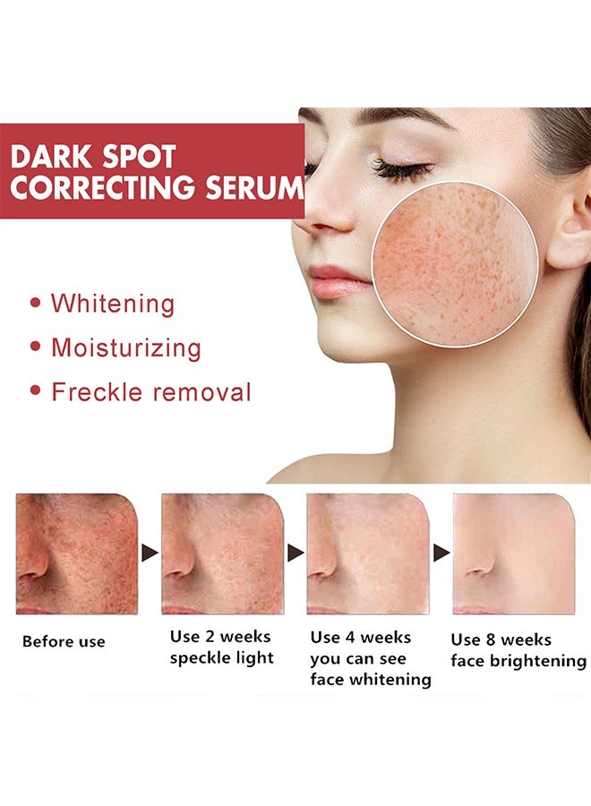 Hoygi Dark Spot Correcting Serum，Dark Spot Repair Essence | Fades Dark Spots, Pigmentation, and Age Spots, Moisturizes and Brightens Skin 30ml  - Image 5