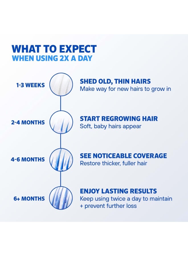 Regaine Men’s Rogaine 5% Minoxidil for Men Foam, Clinically Proven Regrowth for Thinning Hair, Topical Hair Loss Treatment, Unscented Topical Aerosol, Results in 8–16 Weeks, 3-Month Supply, 3 x 2.11 oz - Image 5