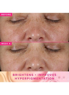 FARMACY 3% Txa Brightening Toner For Face - Powerful Dark Spot Corrector & Face Toner With Azelaic Acid & Pha, 10Ml  - Image 3