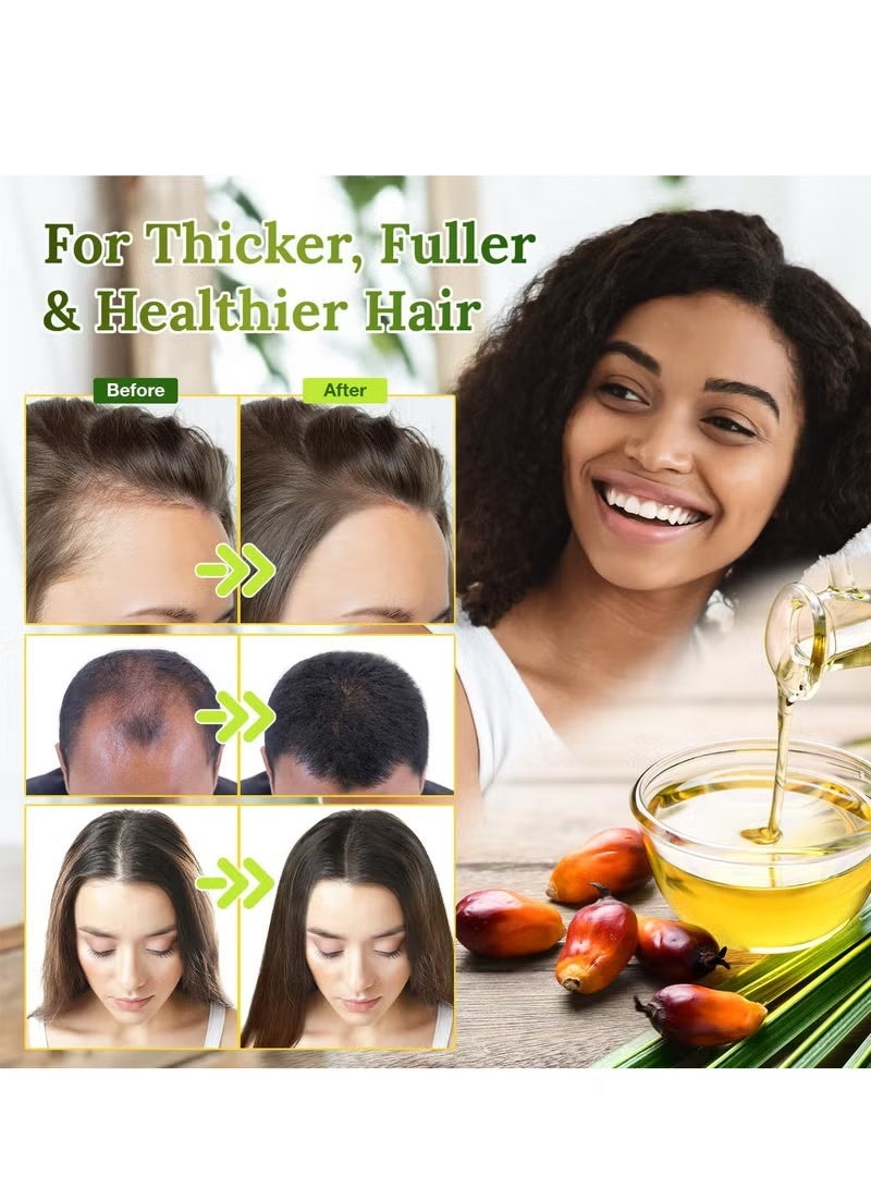 Oil Raw Batana Oil - 100% Natural & Organic Hair Growth Oil Solution for Men & Women, Raw, Unrefined, Enhances Thickness, Prevents Hair Loss - Image 2