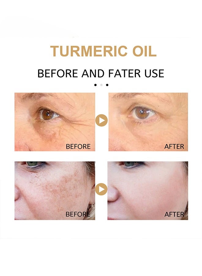 EELHOE - Turmeric Oil 100% Pure and Natural, Pleasant Aroma, Anti-aging, Black Spot Removing and Lighten Spots 30ml - Image 1