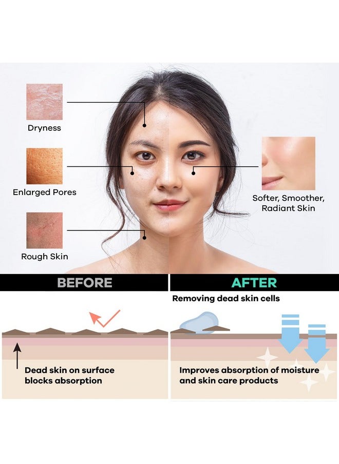 dermasuri - Deep Exfoliating Face Scrub And Body Scrub Mitt Facial Exfoliator & Skin Cleanser Part Of The Best Skincare Kit For Women & Men Cleanse Dead Or Dry Skin Face Exfoliation Tool - Image 1