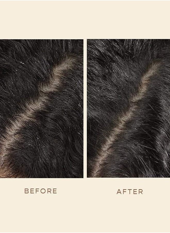 VEGAMOUR - GRO Scalp Detoxifying Serum - Scalp Exfoliator Hair Serum with Zinc PCA, Omega 6 & 9 and Caffeine - Scalp Serum - Image 1