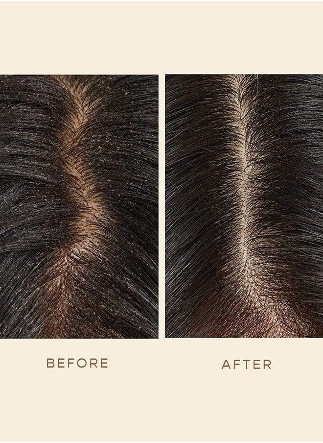 VEGAMOUR - GRO Scalp Detoxifying Serum - Scalp Exfoliator Hair Serum with Zinc PCA, Omega 6 & 9 and Caffeine - Scalp Serum - Image 1