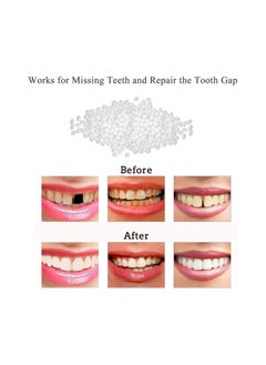 NUMPIG Tooth Repair Kit,Temporary Repair Beads for Missing Broken Teeth Dental Filling Material(100g)  - Image 5