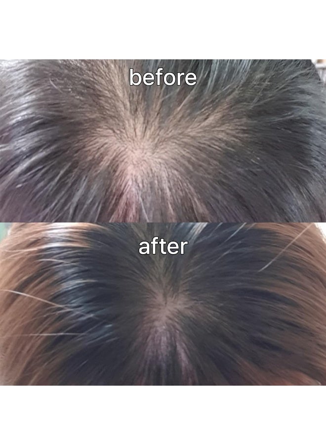 ViveLab US Imported Scalp&Hair Serum for Thinning Hair by Vivelab,15ml–Clinically Tested,Nourishing Formula with Biotin,peptide. Promotes Healthy Scalp&Fuller-Looking Hair - Image 2