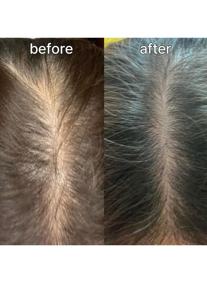 ViveLab US Imported Scalp&Hair Serum for Thinning Hair by Vivelab,15ml–Clinically Tested,Nourishing Formula with Biotin,peptide. Promotes Healthy Scalp&Fuller-Looking Hair - Image 3