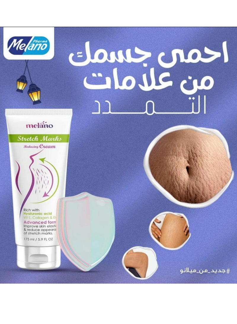 كريم لعلامات التمدد