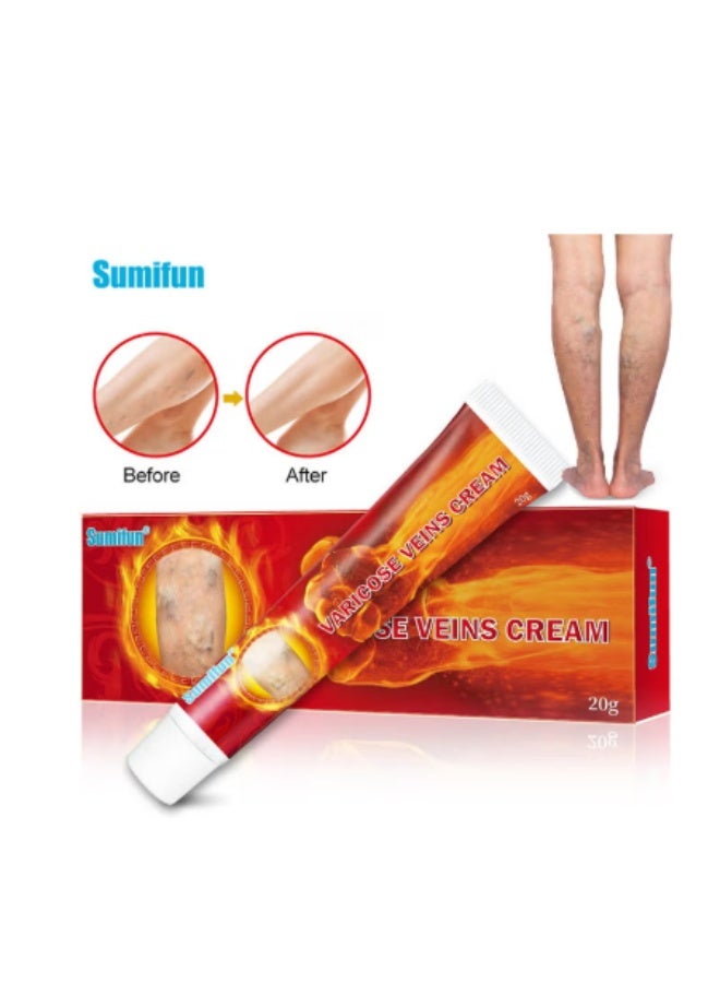 Sumifun Varicose Veins Cream for Legs Reduces Spider Vein , Relieves Pain and Swelling - 20gm - Image 1