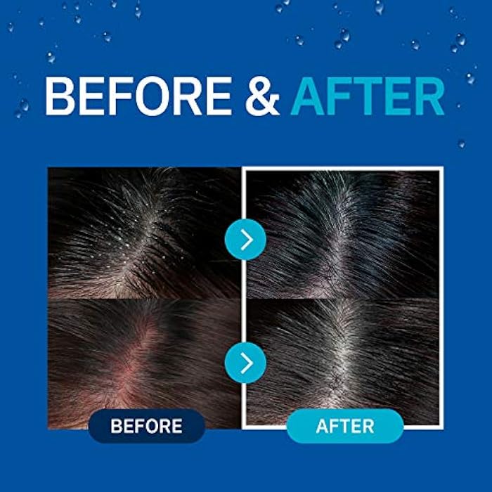 CP-1 Cool Mint Shampoo, for Dry Hair, Relief Icy Menthol, Fresh Peppermint, Scalp Treatment, 16.9 fl oz - Image 4