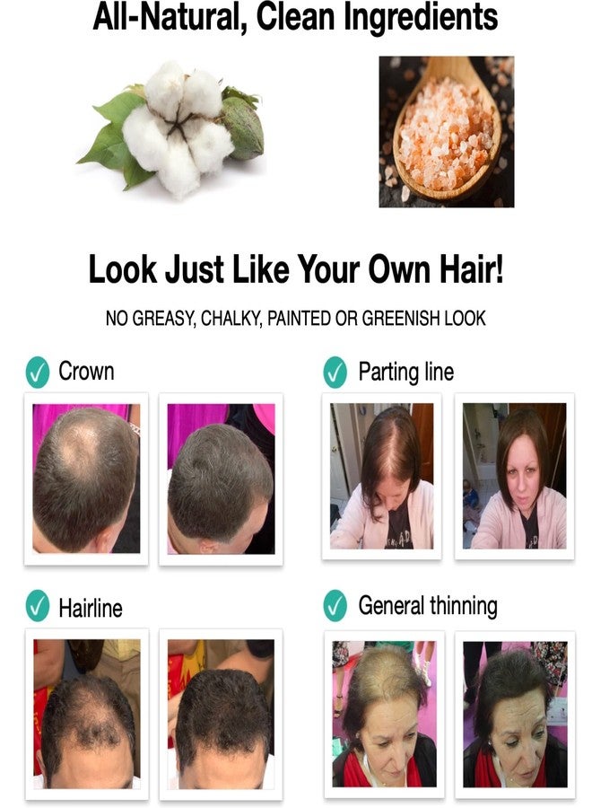 Caboki Hair Loss Concealer. All-Natural Hair Building Fiber. Make Thin Hair Look 10X Fuller Instantly. Eliminate the Appearance of Bald Spot and Thinning Hair (30G, 90-Day Supply). BLONDE - Image 5