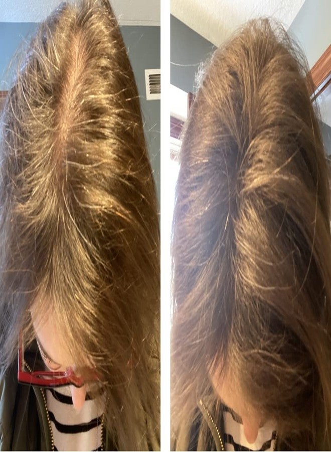 Caboki Hair Loss Concealer. All-Natural Hair Building Fiber. Make Thin Hair Look 10X Fuller Instantly. Eliminate the Appearance of Bald Spot and Thinning Hair (30G, 90-Day Supply). BLONDE - Image 3