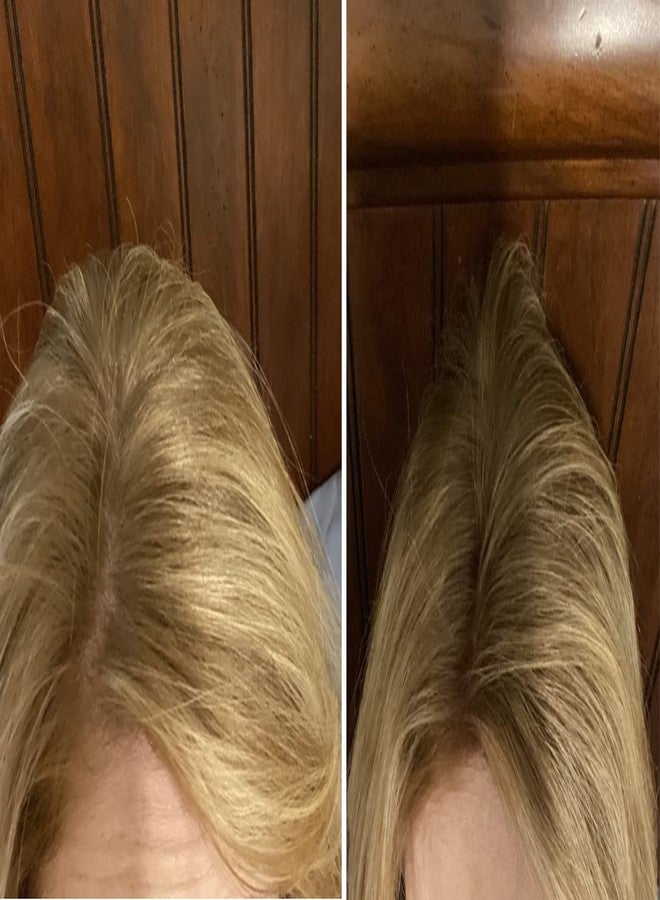 Caboki Hair Loss Concealer. All-Natural Hair Building Fiber. Make Thin Hair Look 10X Fuller Instantly. Eliminate the Appearance of Bald Spot and Thinning Hair (30G, 90-Day Supply). BLONDE - Image 4