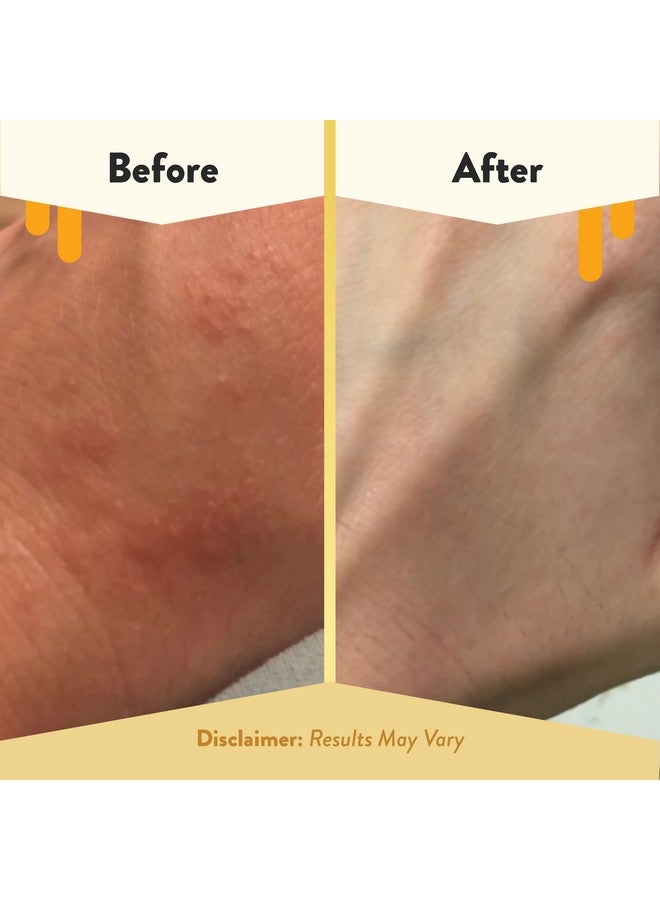 Czema Honey Oatmeal Body Lotion Hand & Body Cream For Eczema Relief Natural Dry Skin Repair (16 Oz)