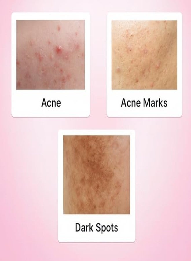 Iguana Alpha Arbutin & Kojic Acid Face Wash (100ml) + Serum (30ml) Combo for Dark Spots, Pigmentation & Skin Brightening | Tan Removal | Uneven Skin Tone | All Skin Types - Image 4