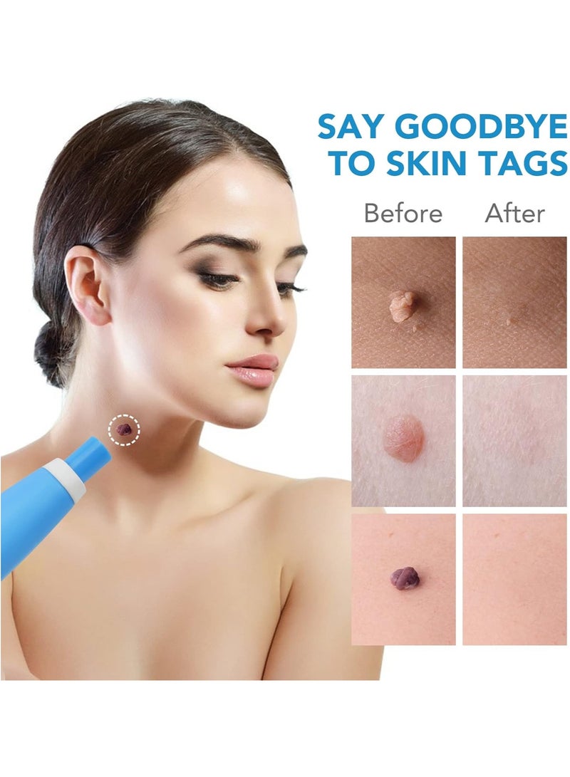 Sefudun Skin Tag Remover Device FDA-Cleared Safe and Effective Skin Tag Removal Kits Home Use - Image 4