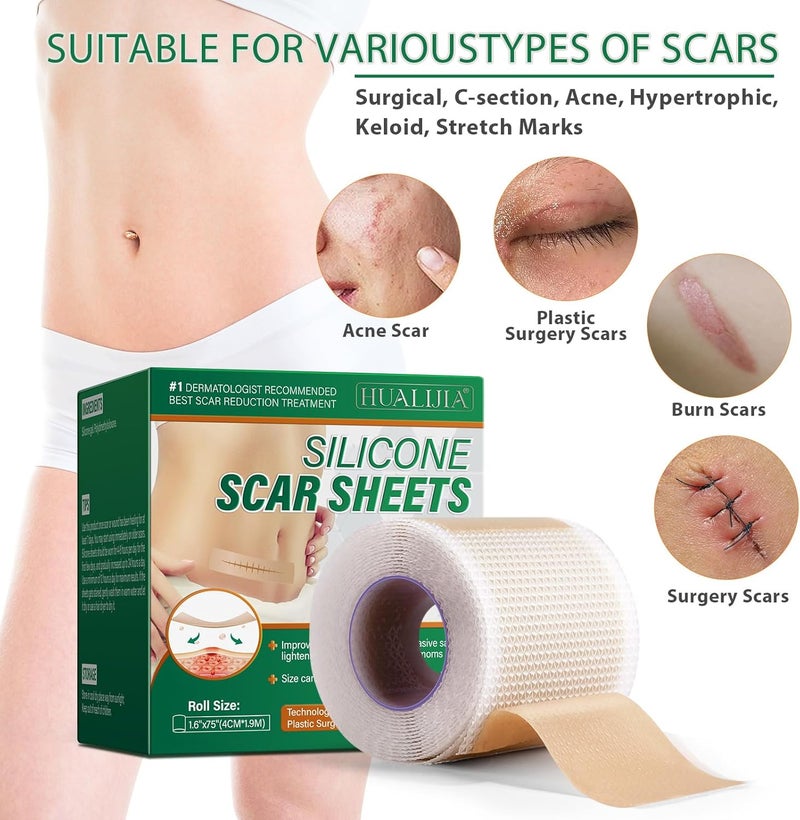 HUALIJIA شرائح سيليكون لعلاج الندبات شريط سيليكون 16x 75 رول 19م شريط طبي لعلاج الندبات للندبات الجراحية شريط سيليكون قابل لإعادة الاستخدام لندبات جراحة القيصرية وشد البطن والندبات الكيلويدية - Image 4