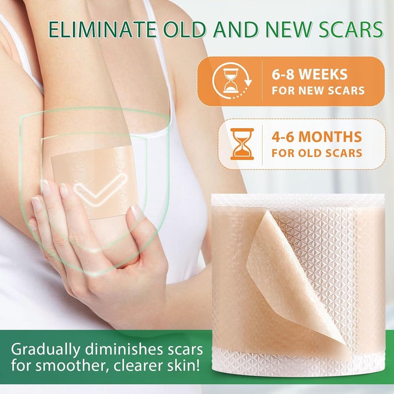 HUALIJIA شرائح سيليكون لعلاج الندبات شريط سيليكون 16x 75 رول 19م شريط طبي لعلاج الندبات للندبات الجراحية شريط سيليكون قابل لإعادة الاستخدام لندبات جراحة القيصرية وشد البطن والندبات الكيلويدية - Image 5